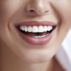 Healthy white smile close up. Beauty woman with perfect smile, lips and teeth. Beautiful Model Girl with perfect skin. Teeth whitening. Healthy white smile close up. Beauty woman with perfect smile, lips and teeth. Beautiful Model Girl with perfect skin. Teeth whitening.
