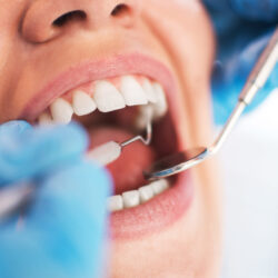 Open female mouth during oral checkup at the dentist. Selective Open female mouth during oral checkup at the dentist. Selective focus.