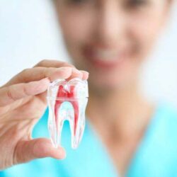 root-canal-treatment-1902 root-canal-treatment-1902